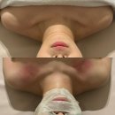 111-운정2-111 | [파주 운정 피부관리] 피부결 에스테틱 - 바이오리필+데콜테 1석 2조 예신 필수 코스 관리 후기