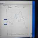 세종보청기 이미지