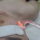 회룡중학교 | 의정부호원동여드름관리 - 사춘기 여드름 고민, 호원동 피부관리샵에서 해결 본 후기