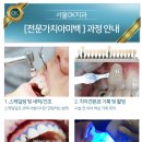 미백세탁 이미지