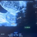 양수1여자 | 17주차 양수검사 예약 / 검사 후기 I 비용 (+ 서초 함춘)