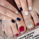 강자안손톱