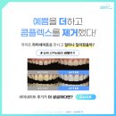 스마일 라인 치과기공소 이미지