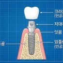 아치치과기공소 이미지
