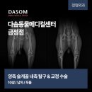 양산동물메디컬센터 | 양산동물병원 갑작스러운 절뚝거림으로 확인된 10살 푸들의 슬개골 내측 탈구 수술 사례