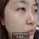 페이스팩토리 IBL멜라튠 피부과디바이스 한달사용 리얼후기