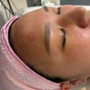 다이아에스테틱 | 순천하빌뷰티에서 받은 다이아 LDM 후기✨ | 순천왕지에스테틱 피부관리 리얼후기