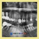 서울라미플란트치과교정과치과의원 이미지