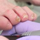 부성초등학교 | 두정동 발톱무좀 관리 사례, 82세 어머님을 위한 맞춤 풋케어 후기[풋풋한케어]