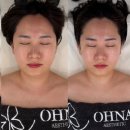 와우에스테틱 | 대구 달서구 두류동 피부관리실이중턱 턱라인 관리 잘하는 오나에스테틱 재방문 후기