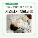 가와사키병 치료 과정부터 병원비까지 : 면역글로불린, 아스피린, 심장초음파 상세 후기
