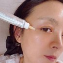 ㈜슬로 | 아이크림 하나로 홈케어, EXOMEREG 아이론 샷 크림 사용 후기