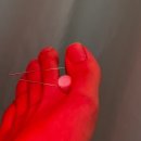 H9199 | 저음역대 돌발성난청.. 이비인후과랑 한의원