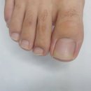 레푸스&에이레네