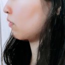 연세여우치과 | 홍대역 교정 연세여우치과 교정 정밀검사 후기와 팁 전후시뮬레이션 NO광고