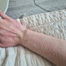 총각네 올림픽점 | [30살-6월 기록] 어서와 여름아