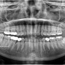 더바른윤치과의원 이미지