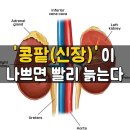 간 손상~~~ 이미지