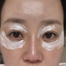 민위멍 | 눈밑꺼짐과 탄력강화를 위한 민클리닉 아이리쥬란 후기