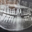 동탄센트럴치과병원 이미지