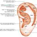 이혈요법 이미지