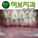 허브치과기공소 이미지