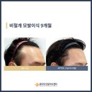 강남로미모의원 | 강남로미모의원 시설 깔끔으로 유명한 곳의 회원권 할인 혜택
