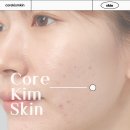 킴에스테틱 | 강남역피부관리샵 여드름관리 잘하는 코어킴에스테틱 추천후기