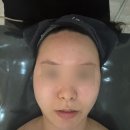 엑스날목동 | 목동에스테틱 추천 엑스날, 목동 피부진정관리 제대로 받고 온 후기