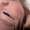 졸업 🐣ㅣbcg 피내용 접종 &amp; 1차 영유아검진 | 자연단유 후기 | DIY 탯줄도장 | 엄마 일상(피부과/다이어트)
