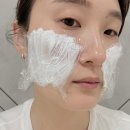 강남 쥬베룩볼륨 후기 통증 망설임 극복한 옆볼 꺼짐 4주차 변화