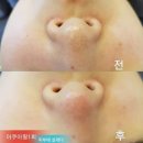 피부에설레다 이미지