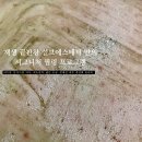 제생바이오 | [대전피부관리 봉명동피부관리 유성피부관리] 등드름, 좁쌀여드름 이제 끝! 대전 필링 관리는 설브에서!