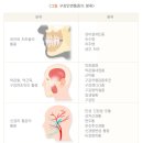강치과 네이버블로그