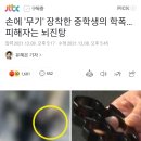 손에 '무기' 장착한 중학생의 학폭…피해자는 뇌진탕 이미지