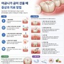 사랑치과기공소 | 일상:치과치료/어금니깨짐,청담동치과 추천(내돈내산)