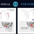 압구정라인성형외과의원 이미지