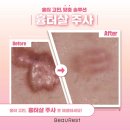 뷰레스트의원 이미지