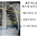 메트로속내과의원 이미지