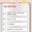 고양이속눈썹