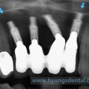 연세휴치과보철과치과의원 이미지
