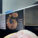 아라스시 이미지