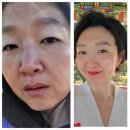 필러 맞은 것 같은 탄력! 인셀덤 더마톨로지 크림 리얼 후기