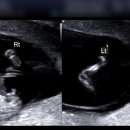 우먼피아여성병원 이미지