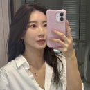 귀족 | 자가얼굴지방이식 + 귀족수술 솔직후기 ...( 이거 올릴까말까 고민했어요..)