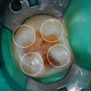 정원치과기공소 이미지