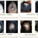 모생한의원 Daum카페