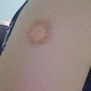 강남바른내과의원 이미지