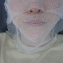 메디스메디칼 | 김포 구래동피부관리 초이스뷰티 콜드플라즈마 물방울리프팅 후기