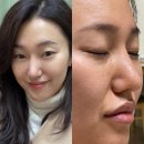 여주-0009 | [공지] [공동구매11월25일오픈]다이브포웨이뷰티디바이스,다이브디바이스,고주파리프팅케어,이온소노부...